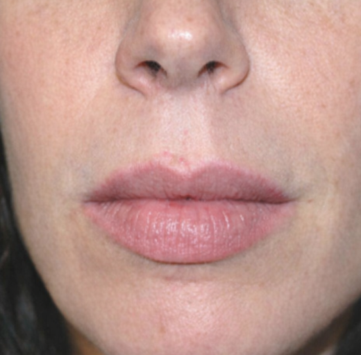 Before/After Image